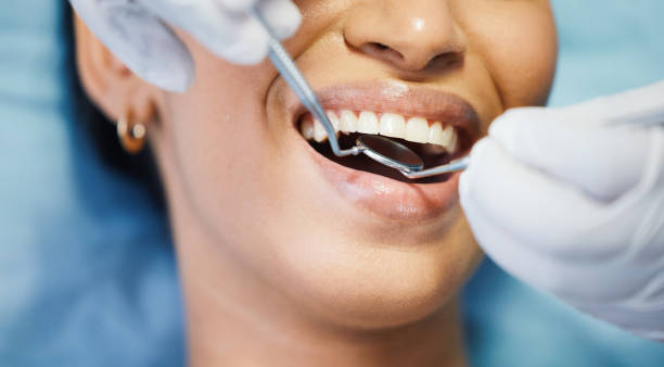Best Walk-In Emergency Dentist in Chamberlain, SD